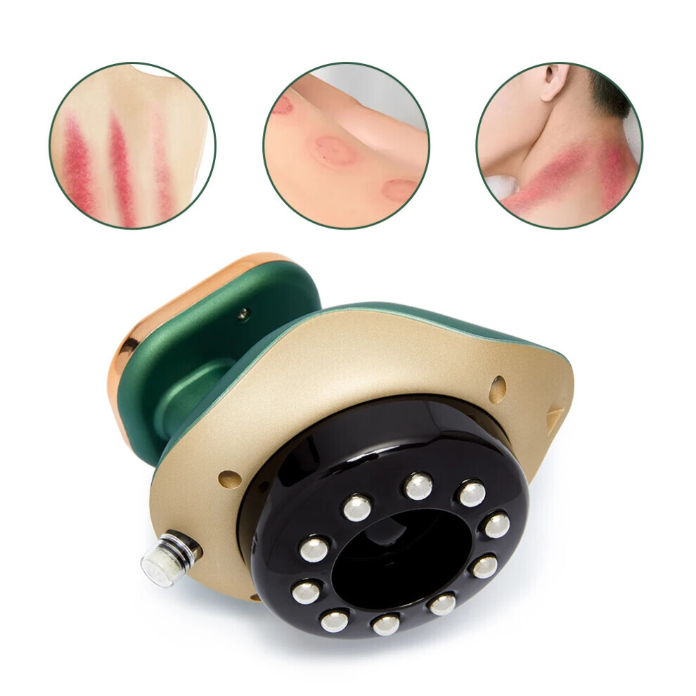 Goplushtoy Electric Cupping Massager Guasha Scraping Vacuum Suction Cup Ir Heating Fat Burner Slimming Body Massage Display Uk