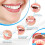 Teeth Plaque Remover with Sonic Cleaner, Dental Calculus 8