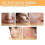 glycolic acid 7 2