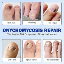 (2Bags) oenail Fungus Patch Waterproof Nail Repair Patches Nail Ingrown Correction Stickers 1/2/3/4/5Pcs for Discolored Or Damaged Nails