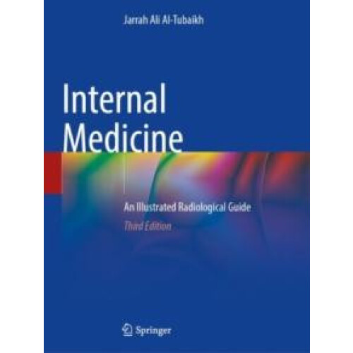 Internal Medicine by Jarrah Ali AlTubaikh Paperback Book