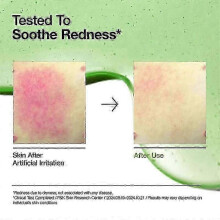 Anua Hyaluron Acid 10 Serum for Redness Soothing 30ml