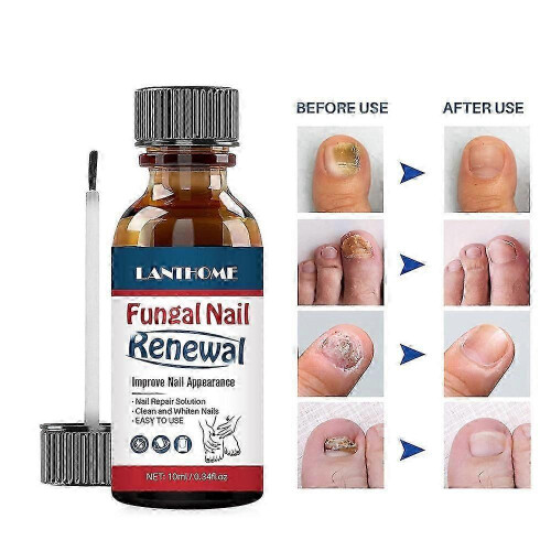 Lanthome Nail Repair Liquid Gentle Care 10Ml 2
