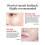 3x Dark Spots Remover Melasma Freckle Sun Spots 4
