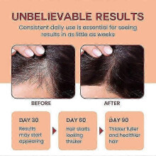 Raw Batana Oil for Hair Growth - 100% Pure, Organic Batana from Honduras for Thick and Strong Natural Hair - Scalp Mask for Men & Wome