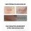 Fruchtsäure-Peeling-Gesichtsessenz AHA 30 % BHA 2 % 30 ml 5
