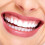 Instant Veneers Boven- en Onderzijde 2 stuks CTR761C 3