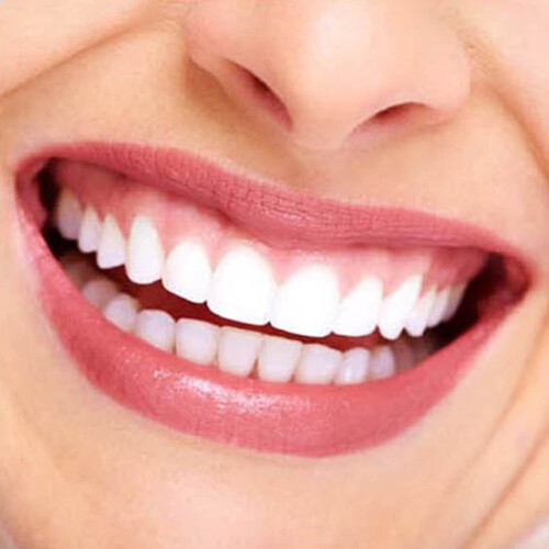 Instant Veneers Boven- en Onderzijde 2 stuks CTR761C 2
