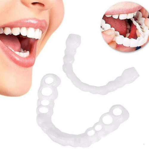 Snap-On Smile Tandenfacings Bleekset2 1
