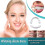 Snap-On Smile Tandenfacings Bleekset2 4