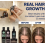 Moérie Hair Growth Shampoo Conditioner 4 Set 3