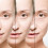 Micro Infusion System for Face 0.25mm and 0.5mm Applicators 5