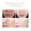 Exfoliating Gel for Gentle Cleansing and Pore Refining 3