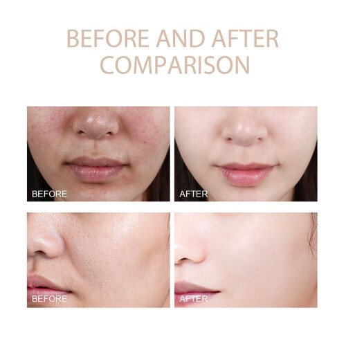 Exfoliating Gel for Gentle Cleansing and Pore Refining 2