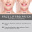Face Lift Tool for Double Chin and V-Shaped Face 40pc 4