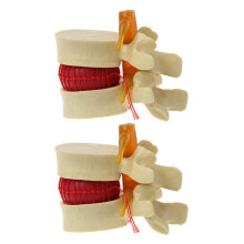 Lumbar Vertebrae Model Anatomical 2-piece