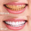YATLTE Charcoal Toothpaste Whitening Antiplaque 5