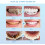 YATLTE Charcoal Toothpaste Whitening Antiplaque 6