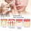 Acne patch hydrocolloid large size 36 pcs 8