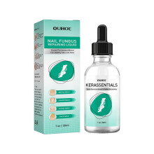 Kerassentials toenail fungus treatment 15ml