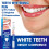 Teeth Whitening Pen Dazzling White Instant 4 3
