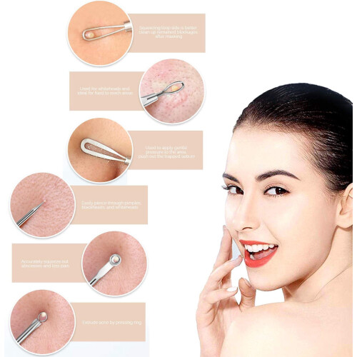 Blackhead Remover Kit Silver 7-Piece 2