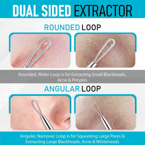 Blackhead Remover Tool Stainless Steel 304 2