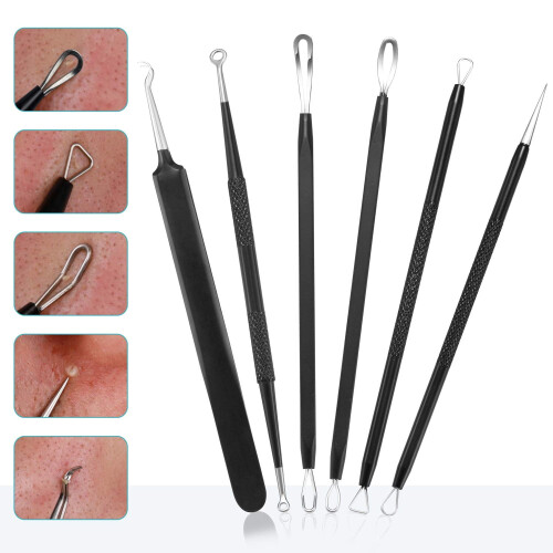 Blackhead Remover Tool Kit Stainless Steel 6-Piece 1