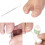 Ingrown Toenail Corrector Tool Set 10 Pieces 2