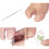 Ingrown Toenail Corrector Tool Set 10 Pieces 8