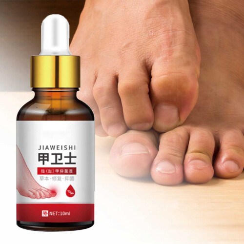 Antibacterial Nail Solution Herbal Fungal Treatment 30ml 2