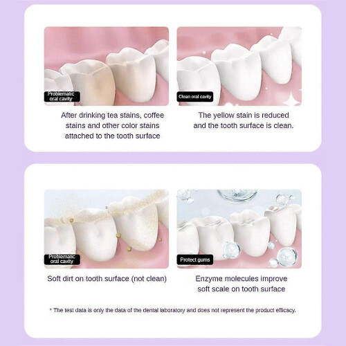 3pcs Hydroxyapatite Toothpaste Probiotic Whitening Toothpaste 100g 2