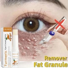 (Matches the image) Eye Fat Granules Removal Eye Stick Anti-Puffiness Firming Cream Anti Inflammatory Fade Fine Line Repair Skin Barrier Skin Care