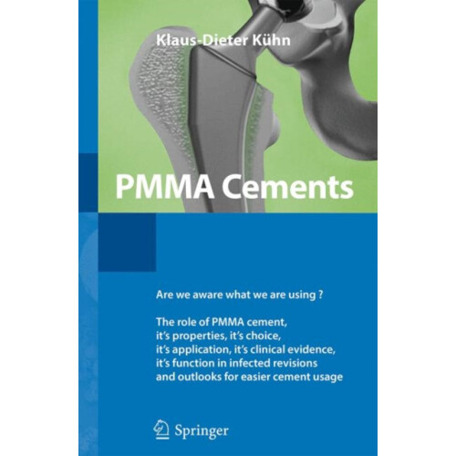 PMMA Cements by KlausDieter Kuhn Paperback Book