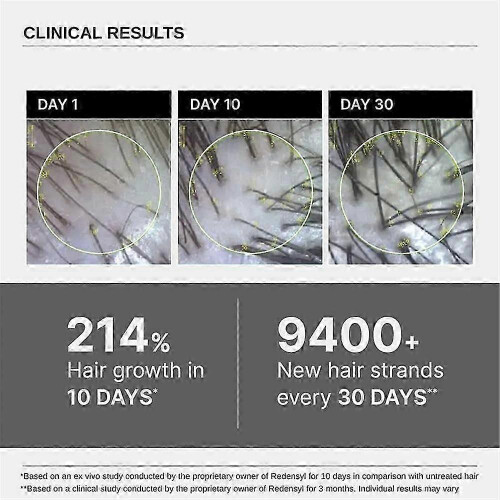 (1) 1-5x Bare Advanced Hair Growth Serum 30ml 2
