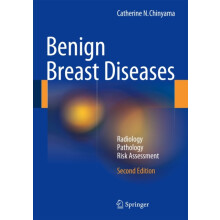 Benign Breast Diseases by Catherine N. Chinyama Hardcover Book