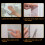 PHOGARY Mosquito Net for Windows, [Upgrade] 3 Fly Screens Window Mesh 1.3mx1.5m 6