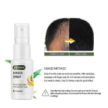 Spray Regrowth Spray 20ml Fast Hair Growth Fluid Anti Loss Treatment Essence Prevent Hair Loss Regrowth Spray High Quality new