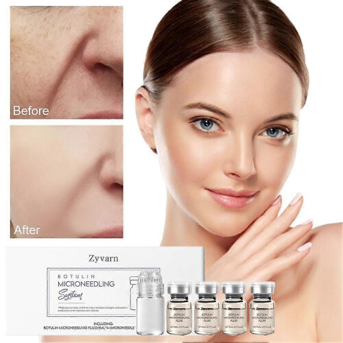 Microneedling Serum Set with Roller Device for Skin Rejuvenation 1