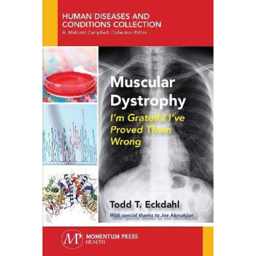 Muscular Dystrophy