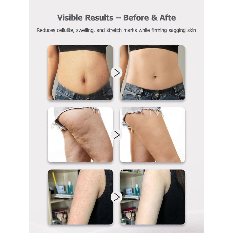 Black Friday Lymphatic Drainage Massager & Anti Cellulite Massage Tool, Helps Reduce Stretch Marks & Cellulite, for Legs, Arms
