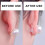 2PCS Earring Lifters - Support for Heavy & Droopy Ears 5