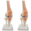 2X Anatomical Knee Joint with Ligaments Model, Life Size 1