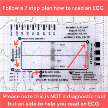 6X EKG 7-Stegslinjal, EKG 7-Stegslinjal för EKG/EKG-Tolkning, Snabb och Snabb Hjärtanalys och Mätverktyg