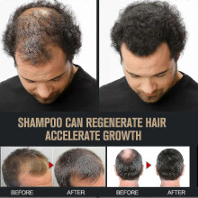 (3pcs) Root Activator Shampoo, Mane Root Activator Shampoo, Shampoo Root Activator Promotes Hair Growth For Men Hair Thickening Shampoo - Wei Ke
