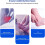Πέλμα πτέρνας Calcaneal Heel Spur 4 τεμαχίων - Ορθοπεδική εσωτερική σόλα πτέρνας από 5