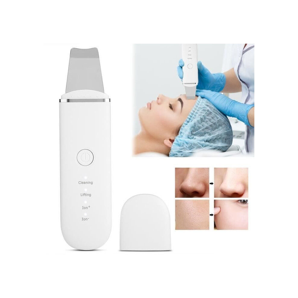 Aihontai Ultrasonic Facial Skin Scrubber Exfoliating Pore Cleansing Pimple And Blackhead Removal Tool - Chd