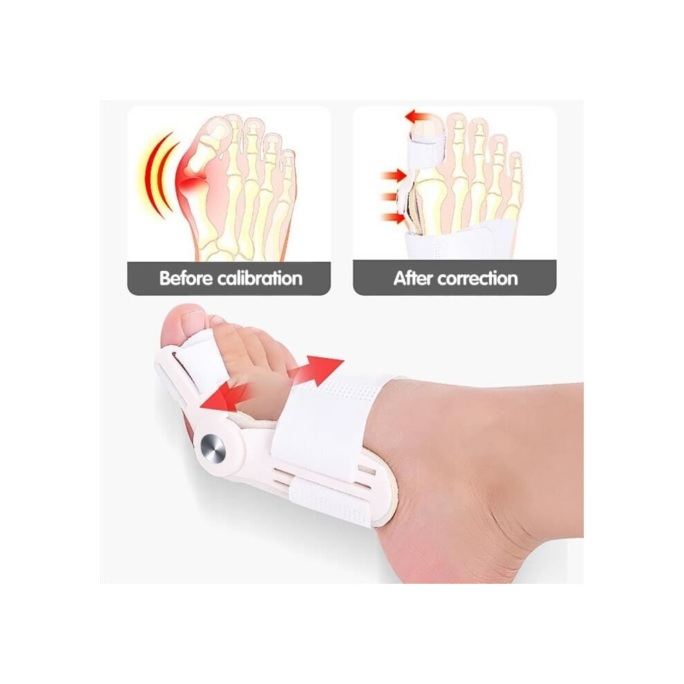 Aihontai Orthosis - Valgus - Hallux Valgus Corrector - Adjustable - Breathable Comfort - Non-Slip