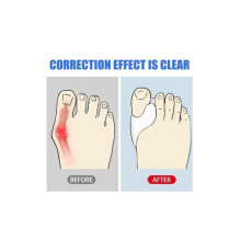Set van 6 paar transparante siliconen teenspreiders, hallux valgus corrector, pijnverlichting
