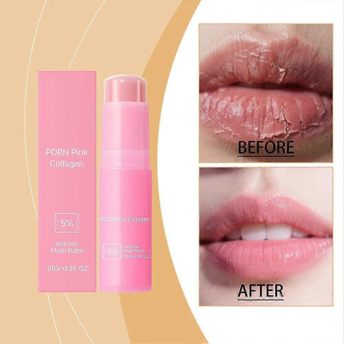 PDRN Pink Collagen 5% Volume Multi Balm 1
